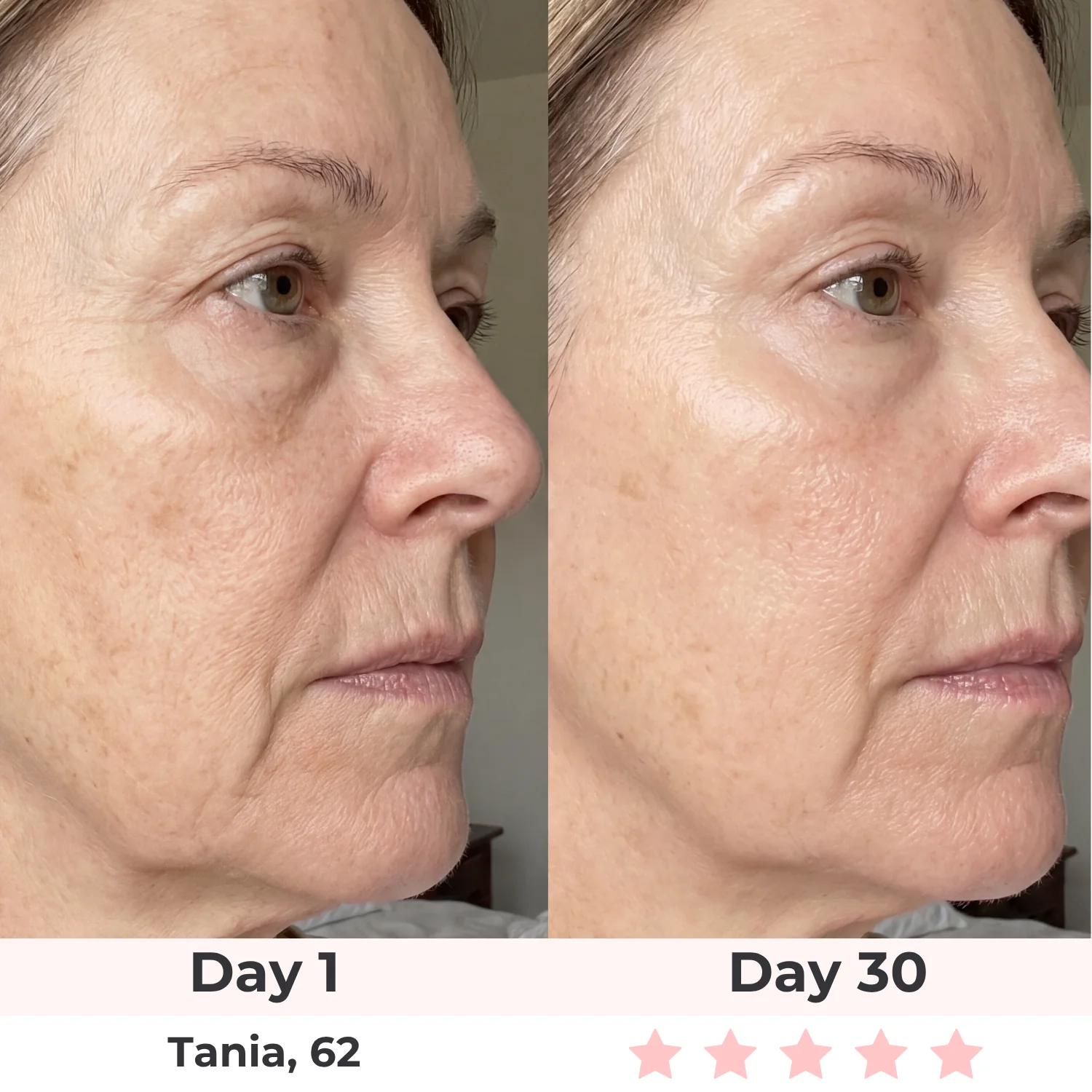 Lux Cove Skin Firming 5-in-1 Hyaluronic Acid Face Serum - Image 4