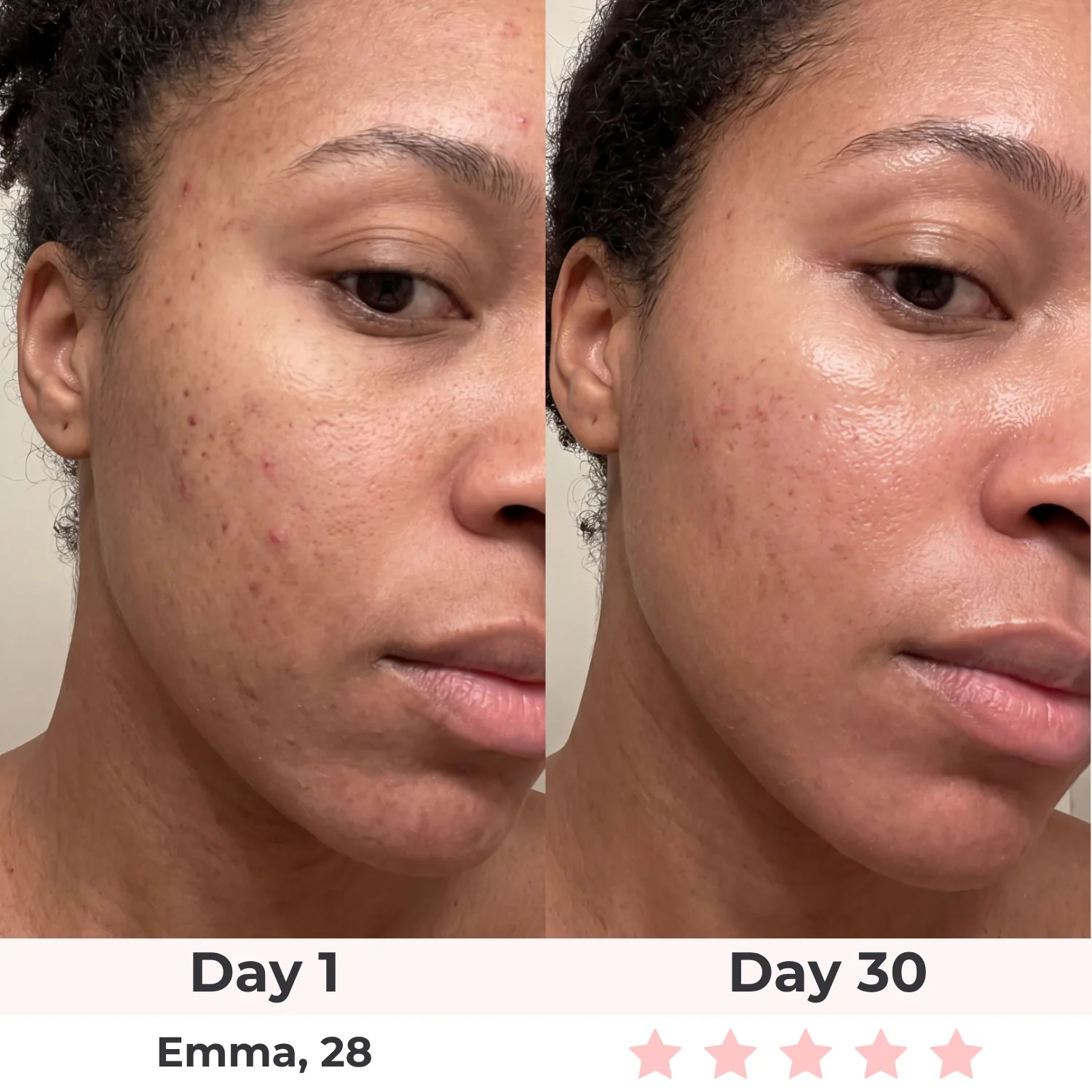 Lux Cove Skin Firming 5-in-1 Hyaluronic Acid Face Serum - Image 7