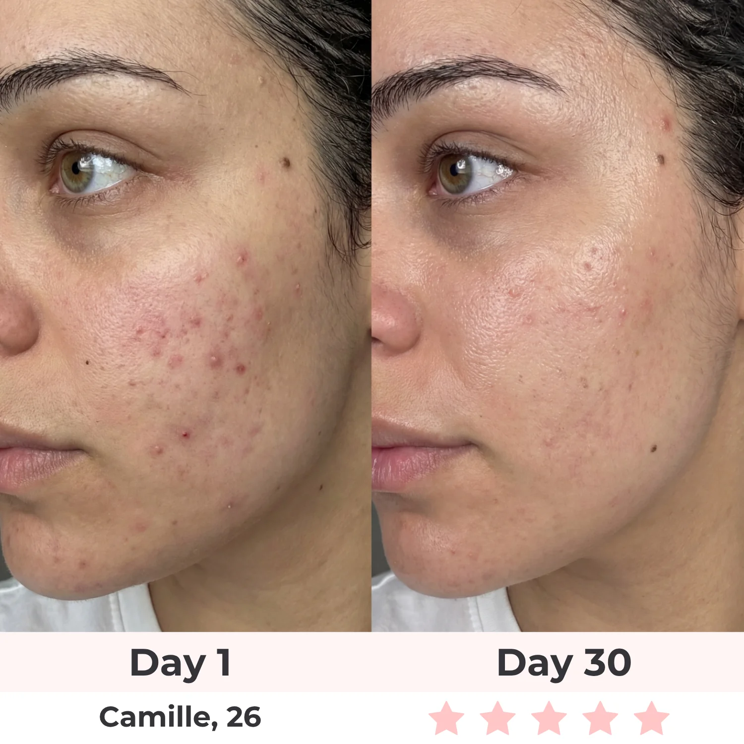 Lux Cove Skin Firming 5-in-1 Hyaluronic Acid Face Serum - Image 9