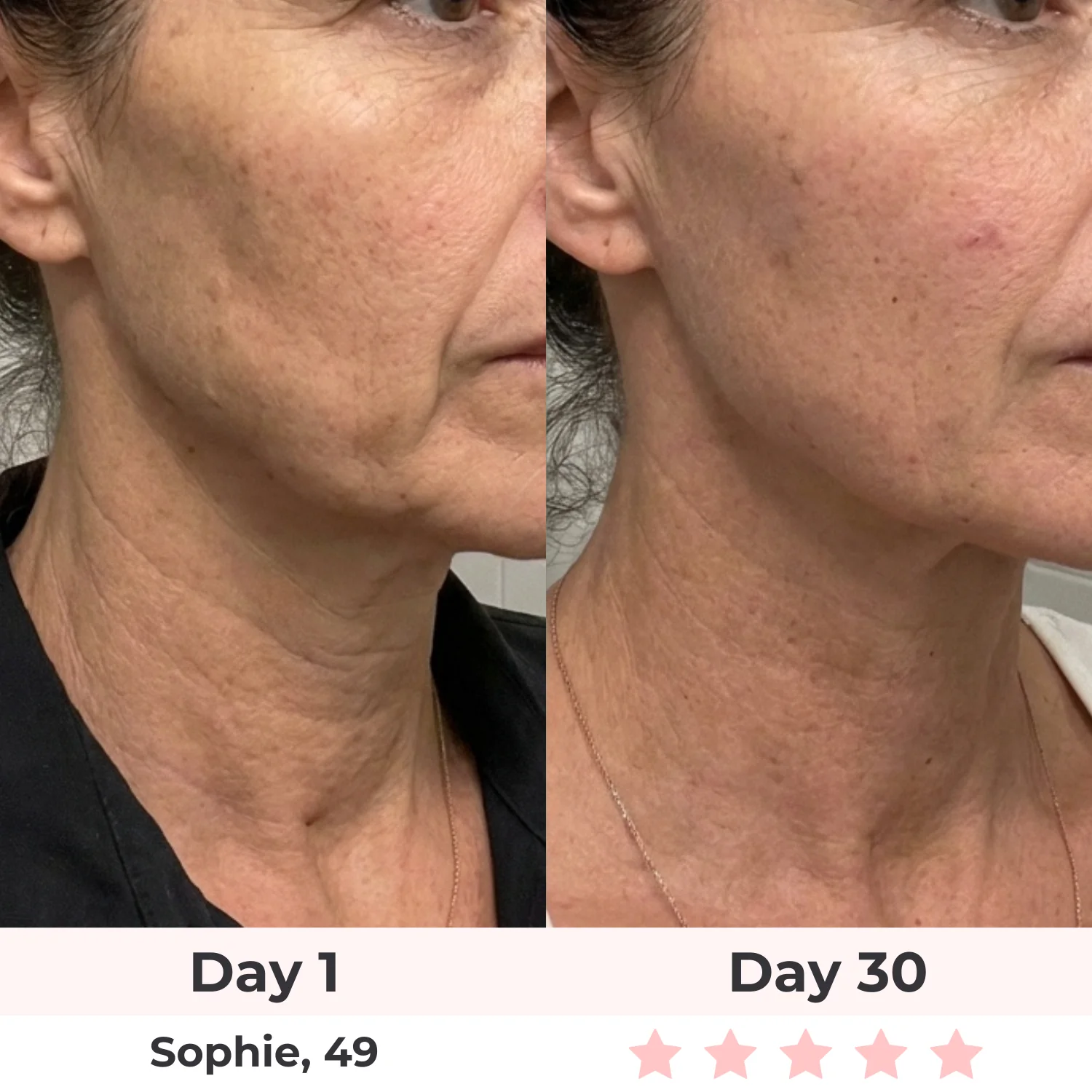 Lux Cove 7-in-1 LED Facial Sculptor - Image 4