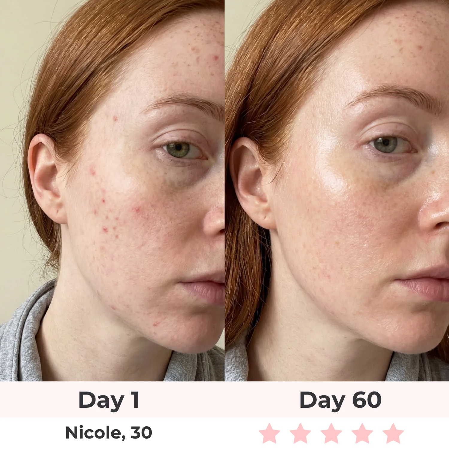 Lux Cove Anti-Aging Vitamin C Serum - Image 8