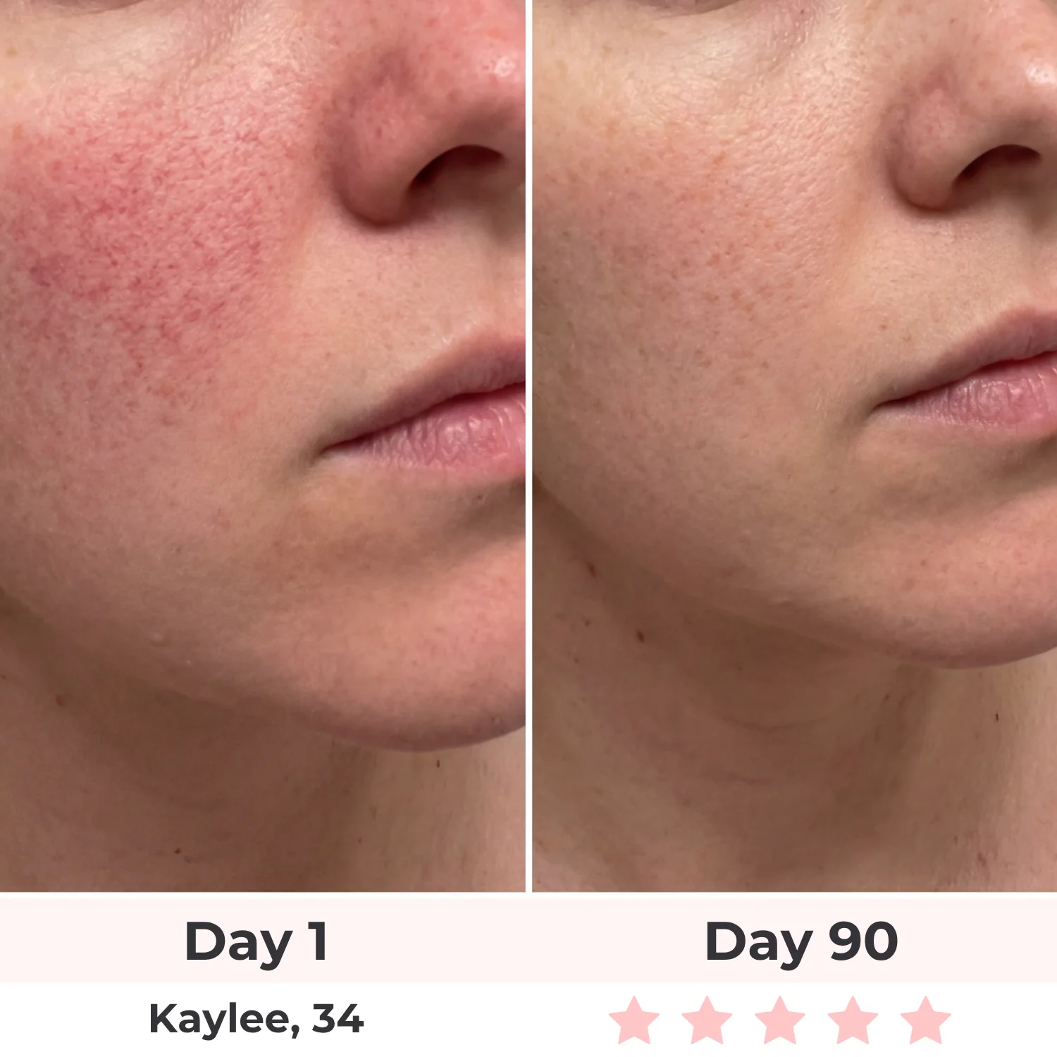 Lux Cove 7-in-1 LED Face Mask - Image 11